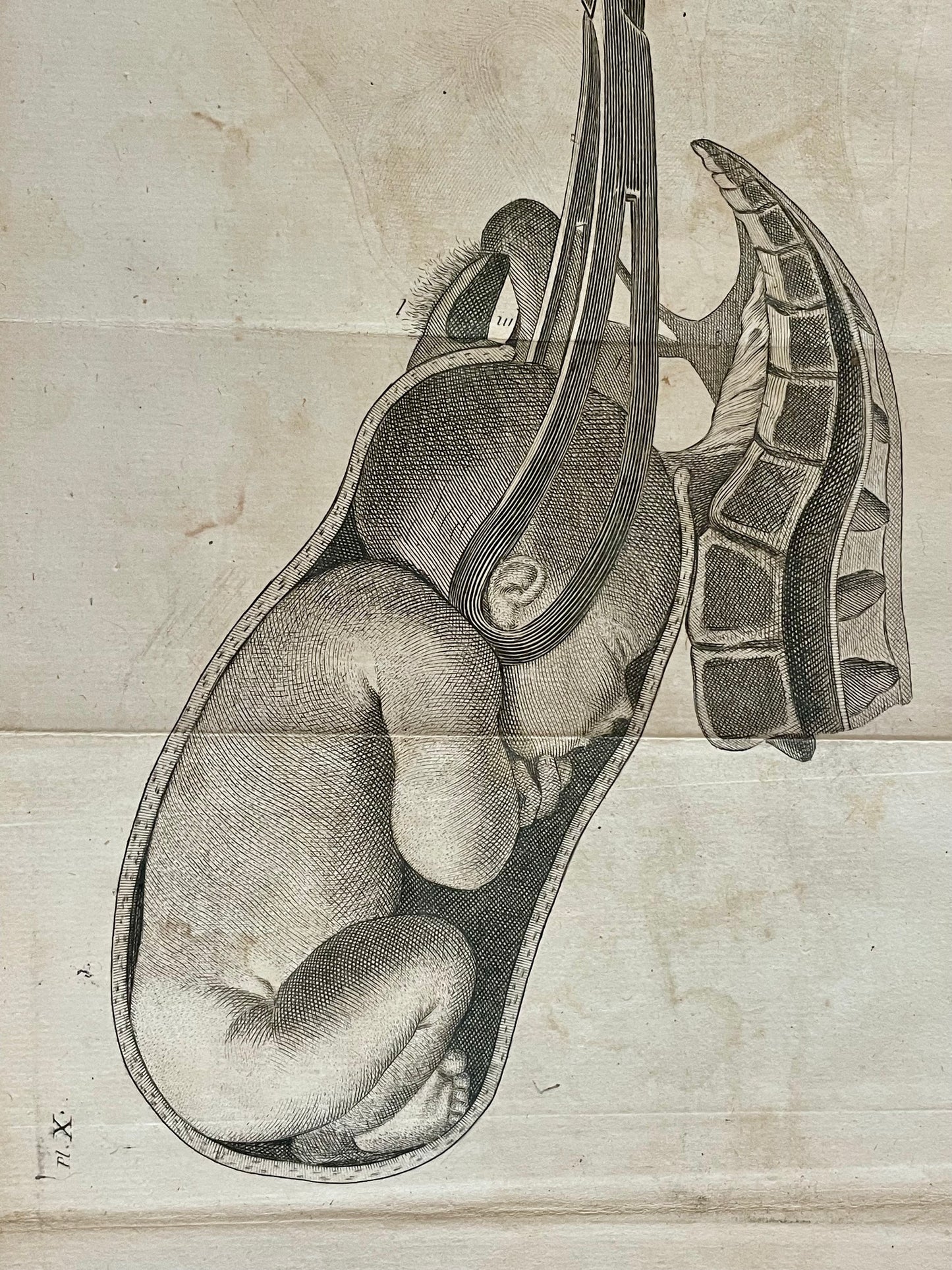 Lotto n. 6 antiche incisioni mediche ostetricia Baudelocque fine ‘700