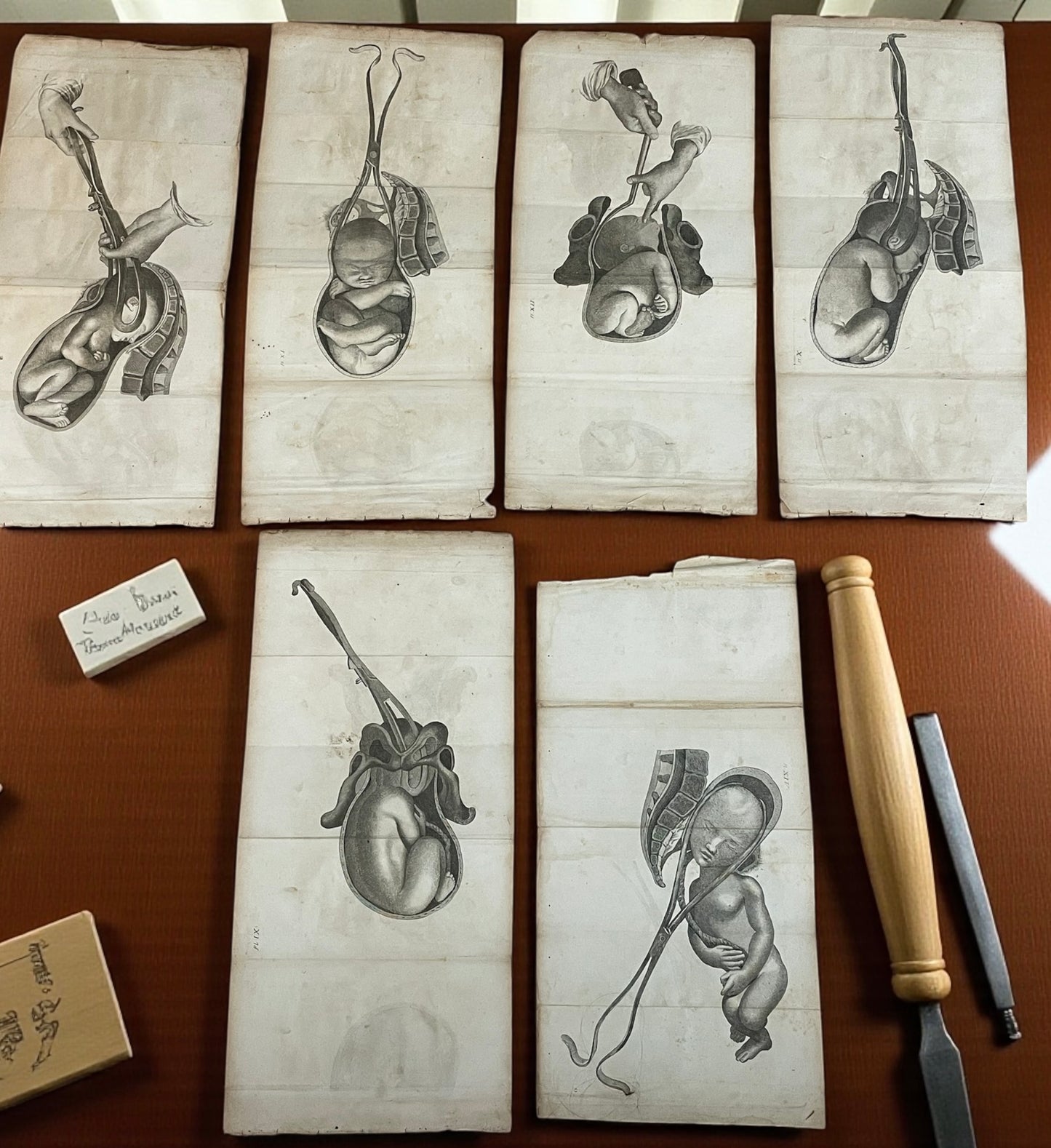 Lotto n. 6 antiche incisioni mediche ostetricia Baudelocque fine ‘700