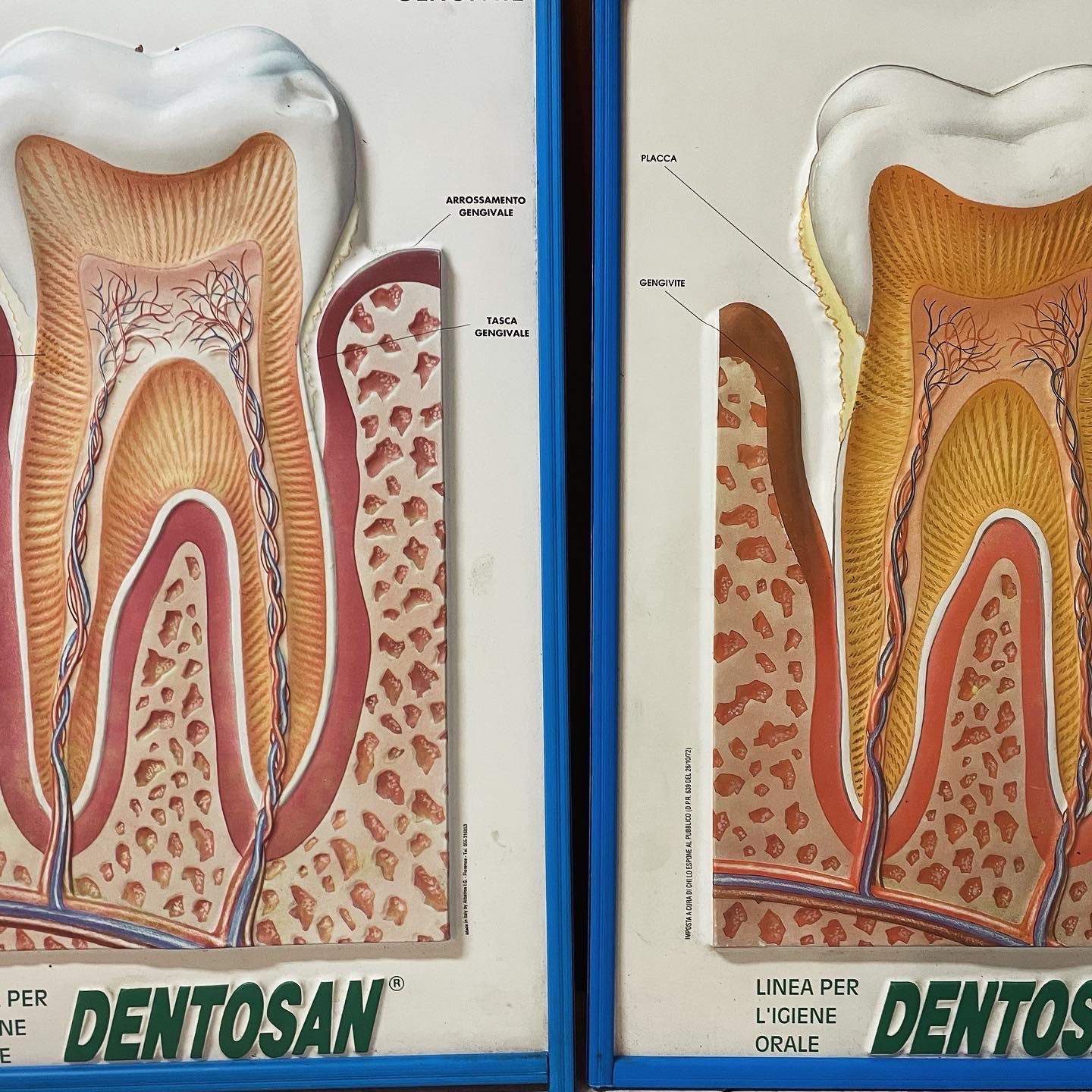 Coppia pannelli studio dentista anni 70