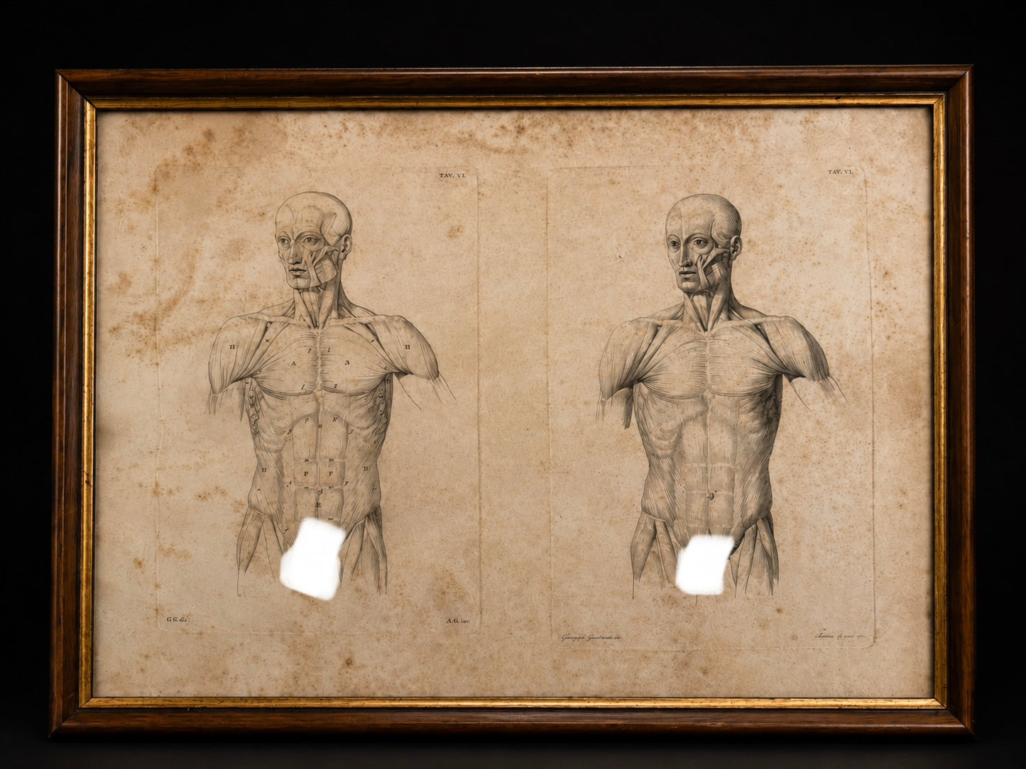 Antica tavola anatomica doppia del 1841 destinata alla Belle Arti, firmata e incorniciata