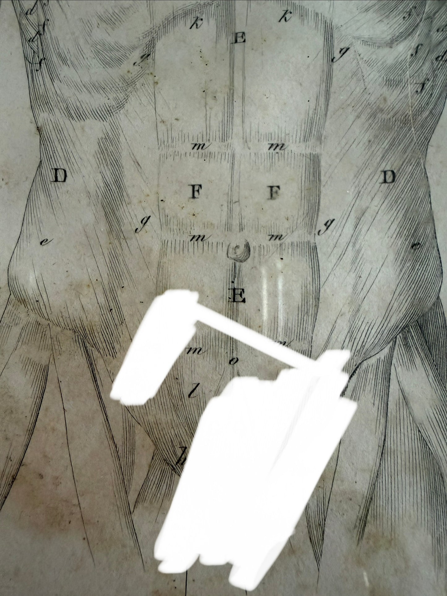 Antica tavola anatomica doppia del 1841 destinata alla Belle Arti, firmata e incorniciata